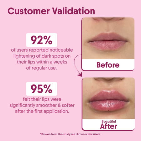 Aravi Organic Beetroot Lip Lightening Scrub - Exfoliates | Brightens & Hydrates Lips - 15gm