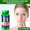 Cipzer Acne & Pimples Capsules Promotes Clear,Healthy Skin,Remove Acne & Detoxifies Skin-60 Capsules