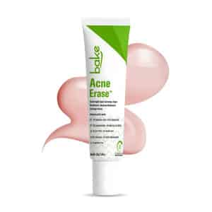 Bake Acne Erase Face Serum With Niacinamide & Azelaic Acid For Pimples | Blackheads & Whiteheads
