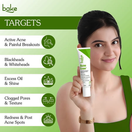 Bake Acne Erase Face Serum With Niacinamide & Azelaic Acid For Pimples | Blackheads & Whiteheads