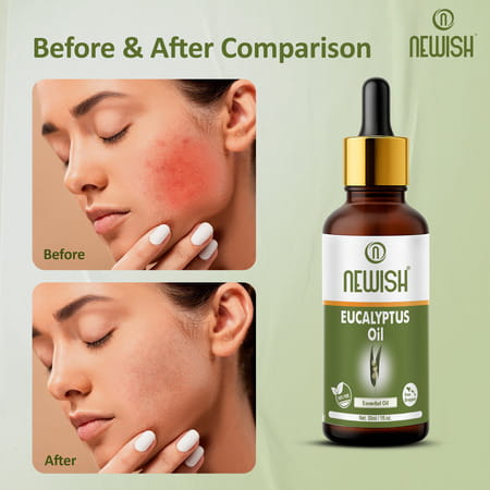 Newisheucalyptus Oil For Hair Pain Relief|Undiluted Aromatherapy Therapeutic Grade 30Ml-Pack Of 2