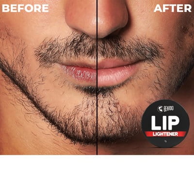 View product image 4