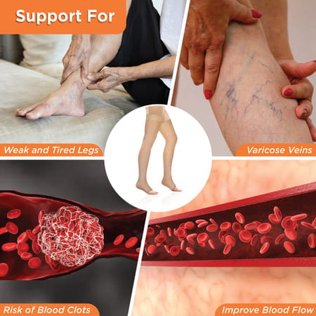 Vissco Medical Compression Stockings Upto Thigh | Improve Blood Circulation | Varicose Vein - Large