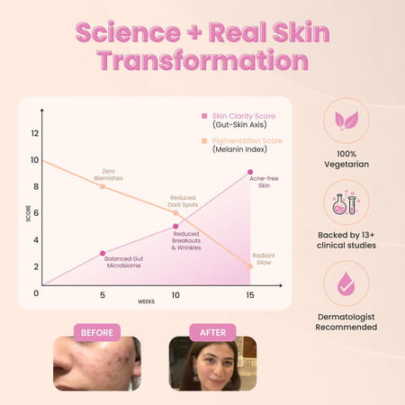 Bug Buddy Time To Shine | For Glowing Skin/Acne Reduction & Healthy Hair | 15 Days Pack