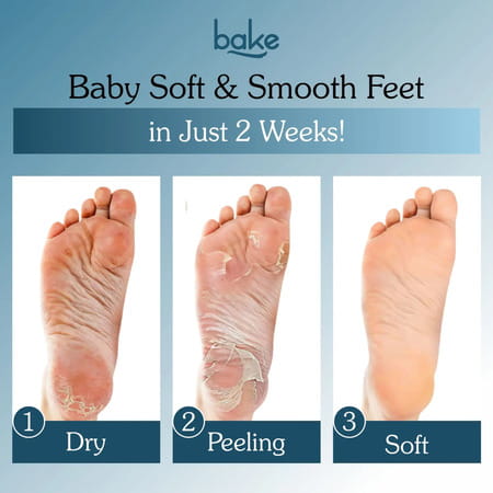 Bake Aha + Bha Foot Peeling Mask For Dry Skin | Calluses & Dead Skin Removal - Sock Type Foot Mask