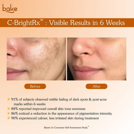Bake C-Bright Vitamin C Serum For Brightening | Dark Spots & Glowing Skin