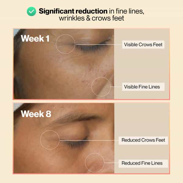 Setu Skin: Youthful Marine Collagen Powder | Unisex - Peach Mango Flavor (15 Sachets)