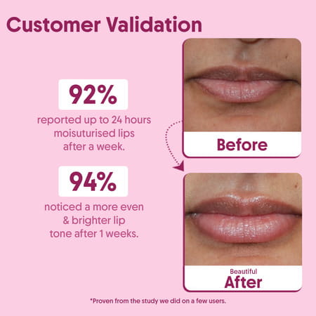 Aravi Organic Beetroot Lip Balm - Moisturizes | Softens & Adds Natural Color To Lips - 8gm