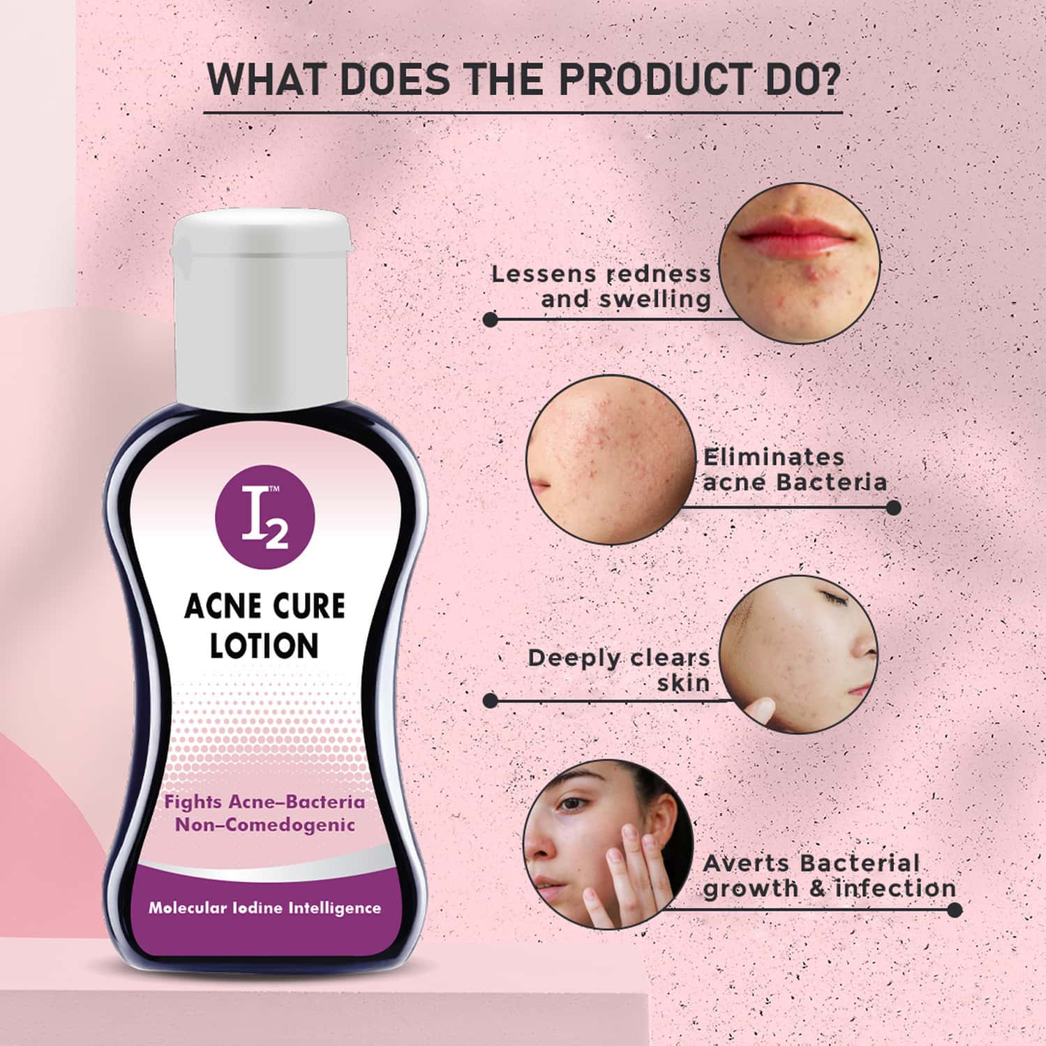 Buy I2 ANTI ACNE CURE FACE LOTION FOR ACNE & BLACKHEADS & OPEN PORE