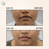 Cgg Cosmetics 70% Snail Mucin Essence( Buy 1 Get1) 0.7 % Cellulose Oil Free- All Skin Types-100Ml