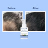 Wishcare Hair Growth Serum Concentrate - Redensyl|Anagain|Caffeine|Biotin|Keratin|Rice Water (30Ml)