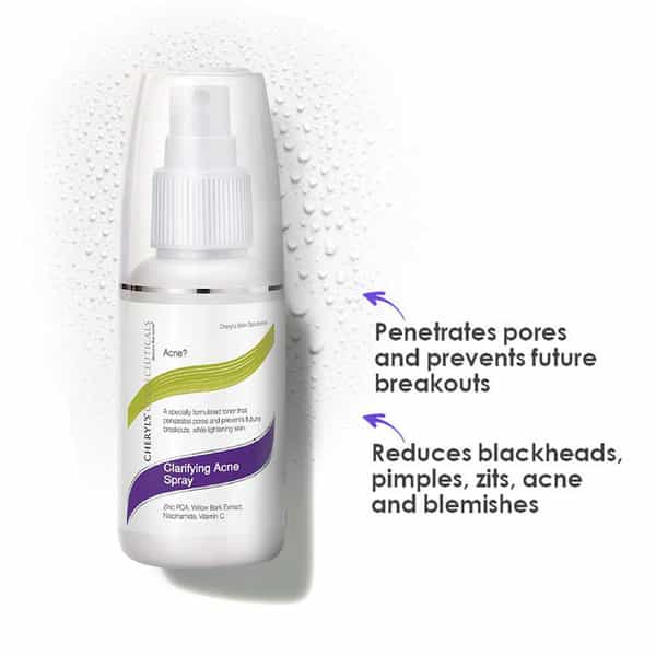 Cheryl's Clarifying Acne Spray - 50 Gm