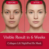 Bake Collagen Peel Off Mask With Matrixyl 3000 For Skin Tightening & Anti-Aging Care (100Ml)