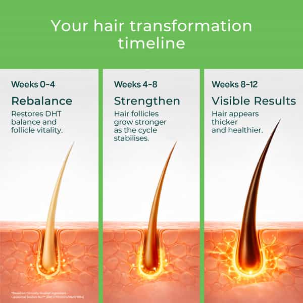Oziva Hair Actives + Shilajit For Men Hair Supplement With Liposomal | 30 Effervescent Tablets