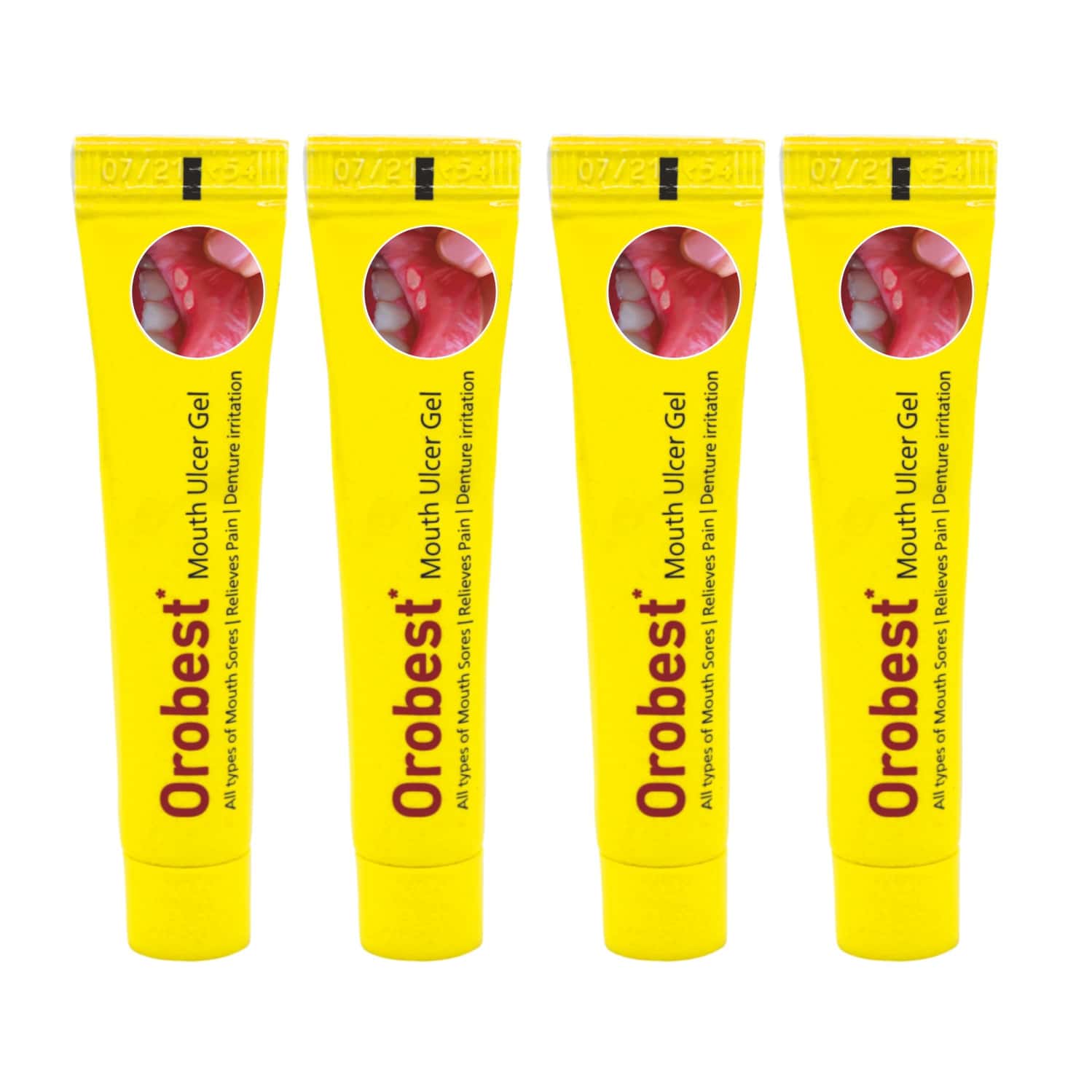 Buy OROBEST MOUTH ULCER GEL 10 GM REDUCES MOUTH ULCERS PACK OF 6