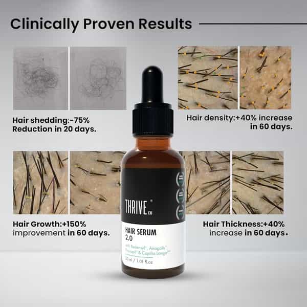 Thriveco Restorative Hair Growth Duo: Hair Growth Serum 2.0 (50Ml) + Hair Vitalizing Shampoo (250Ml)