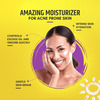 Brinton Acmist Vitamin E & Aloe Vera Based Moisturizing Cream Gel | 50 G X Pack Of 3