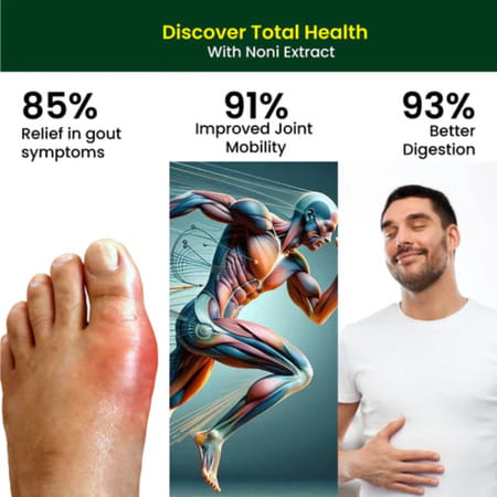 Cipzer Noni 30 Capsules | Supports Joint Health| Reduces Bloating & Promotes Mobility