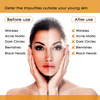 Nutriglow Natural's Advanced Pro Formula Set Of 2 Papaya Facial Kit For Even Skin Tone 60Gm Each