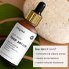 Sirona Anti Acne Face Serum With Tee Tree Oil Salicylic Acid Hyaluronic Acid And Vitamin E - 30 Ml
