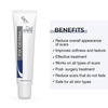 Fixderma Scar Gel | Reduces Acne Scars | Surgery Scars | Injury Scars | Burn Scars - 15g