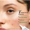 Novology Acne Spot Corrector Fights Active Acne | Whiteheads | Pimples For Acne Prone Skin (30 G)