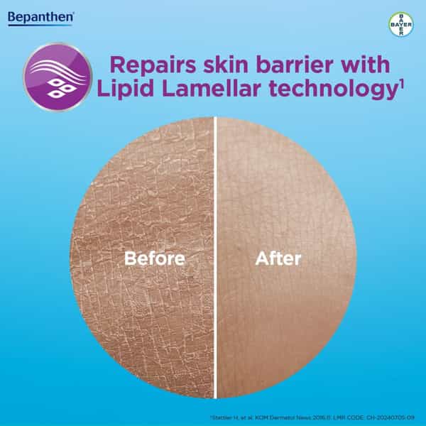 Bepanthen Sensicalm Cream | Worlds No.1 Skincare Brand | Steroid-Free | Itch Relief Cream | 50G