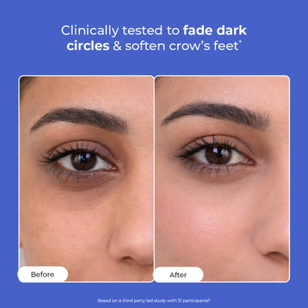 Conscious Chemist Retinol Peptide Under Eye Cream 15Ml | Soothing Roller | Dark Circles & Puffiness