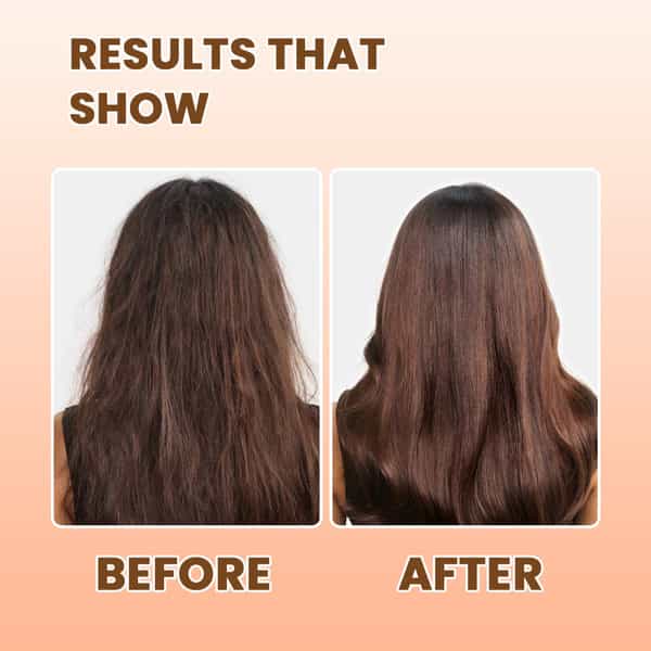 Alglaze Biotin Hair Shampoo | Scalp Purifying | Apple Cider Vinegar| Biotin & Aloe Vera | 200Ml