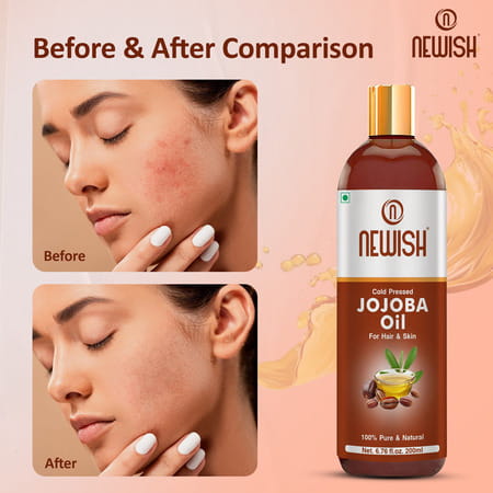 Newish Cold Pressed Jojoba Oil For Skin & Hair Growth - Virgin & Unrefined 200ml