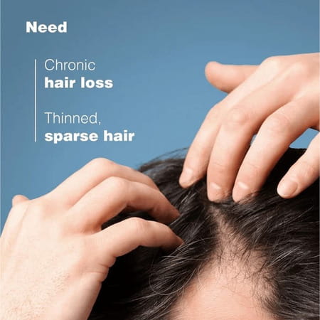 Ducray Anaphase Anti-Hair Loss Anti-Thinning Shampoo - 100ml (Pack Of 3)