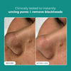 Conscious Chemist Blackhead Melting Water | 50Ml Pore Toner With Glycolic & Succinic Acid