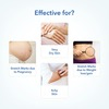 The Moms Co. 7 In 1 Natural Stretch Bio Oil -100 Ml And Natural Body Butter -100G Kit Of 2