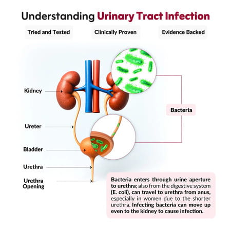 Nutriwave Ut Health | Uti Prevention & Urinary Tract Support | Cranberry Flavour | 30x2g Sachets
