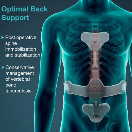 Tynor Ash Brace (Hyper Extension Brace) Silver Short 1 Set