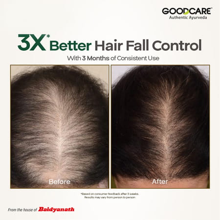 Goodcare Root Boost Hair Oil Rosemary | Men Women | Hair Growth | 100 Ml | Pack Of 1