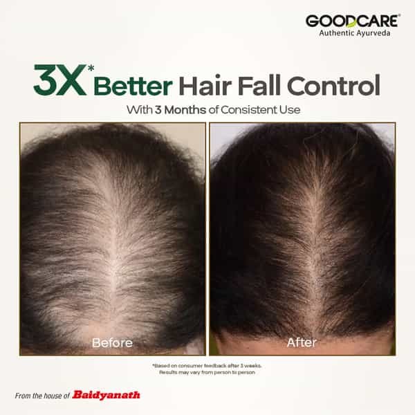 Goodcare Root Boost Hair Oil Rosemary | Men Women | Hair Growth | 100 Ml | Pack Of 1