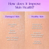 La Shield Intense Hydrating Cream Probiotic Moisturizer 100 Gm