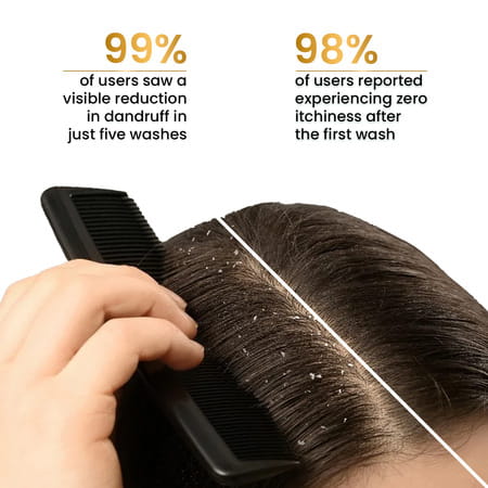 The Skin Story Anti Dandruff Shampoo For Scalp Cleansing Dandruff Control Soothes 250 Ml