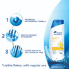 Head & Shoulders Anti Dandruff Lemon Fresh Shampoo -180Ml