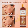 Newish Badam Rogan Oil | Sweet Almond Oil For Hair Body And Skin Unrefined 200ml ( Pack Of 2)