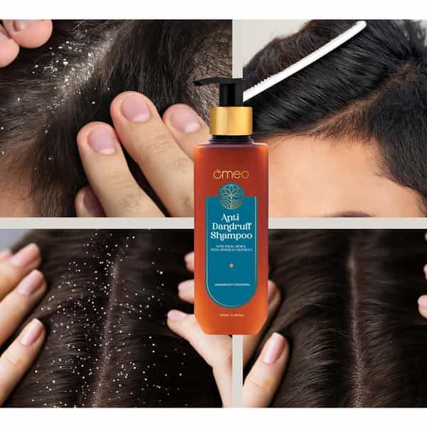 Omeo Anti Dandruff Shampoo | With Neem | Ginger | Arnica | Calendula & Thuja (200Ml)