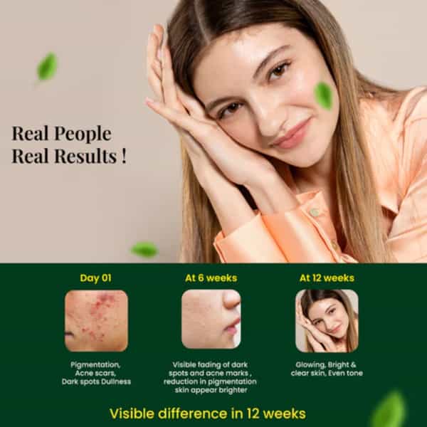 Cipzer Natural Vitamin C Capsules | Fights Premature Skin Aging & Brightens Complexion | 30 Capsules
