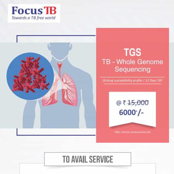 Handbill - Tgs 100 Pcs.