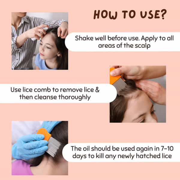 Coco Crush Ayurvedic Lice Remover Hair Oil |100% Natural - 100Ml