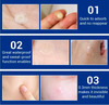 Lanbena Acne Pimple Patch (28 Patches)