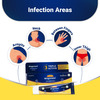 Medisynth Ringoment Cream | Anti Fungal Cream | B.no. 15 | 20Gm Pack Of 2