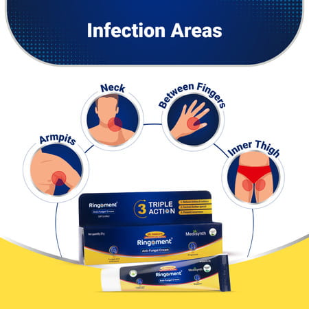 Medisynth Ringoment Cream | Anti Fungal Cream | B.no. 15 | 20Gm Pack Of 2