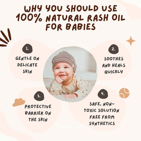 Coco Crush Rash Oil For Babies - Diaper & Nappy Rash Relief | Organic | Prevents Irritation - 200ml