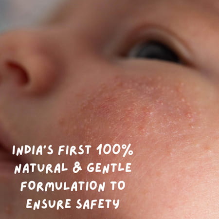 Coco Crush Rash Oil For Babies - Diaper & Nappy Rash Relief | Organic | Prevents Irritation - 200ml